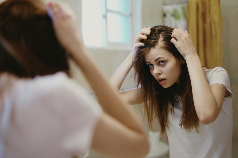 female pattern baldness