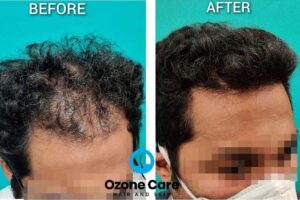 Ozone care testimonial 2